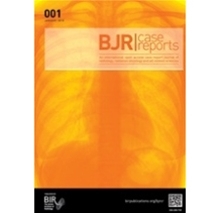 BJR | case reports