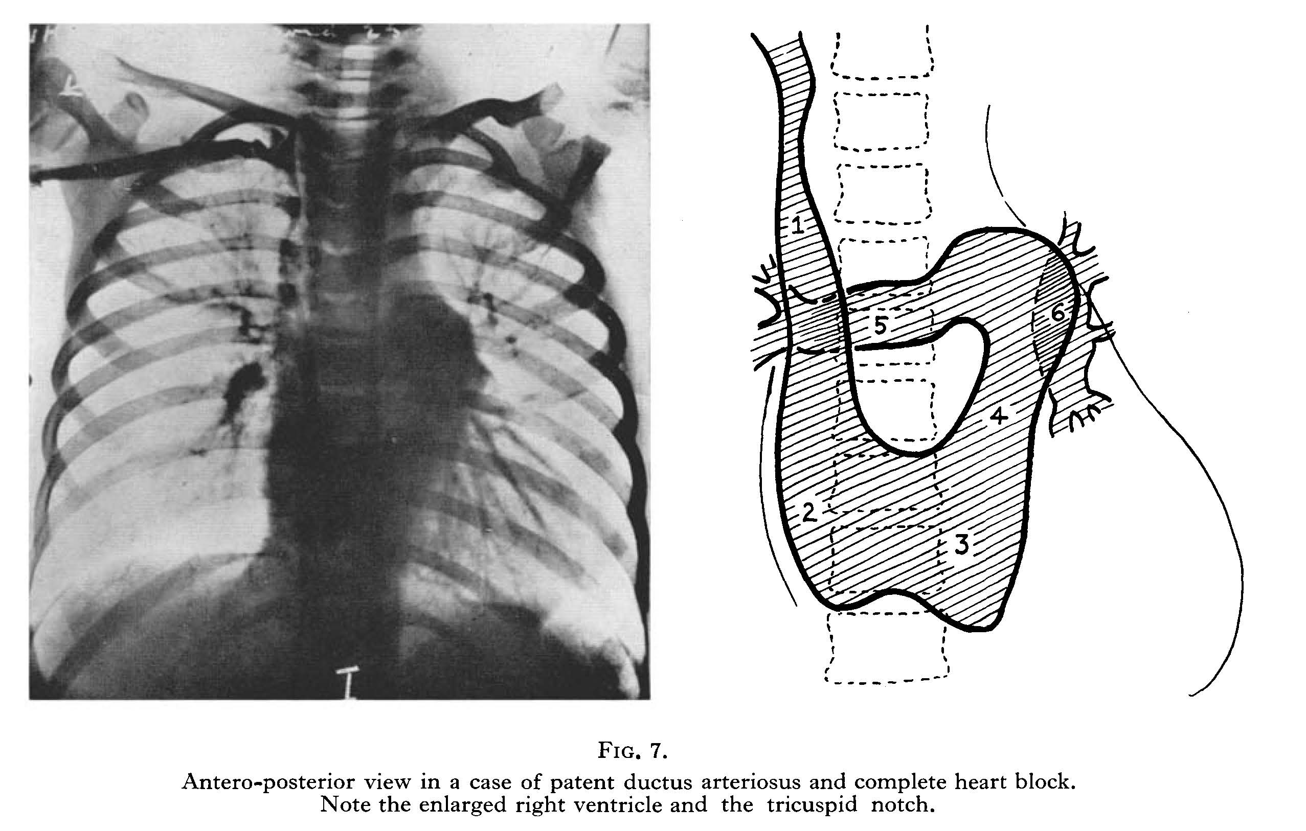 Angiocardiogram21-380-393.jpg Angiocardiogram