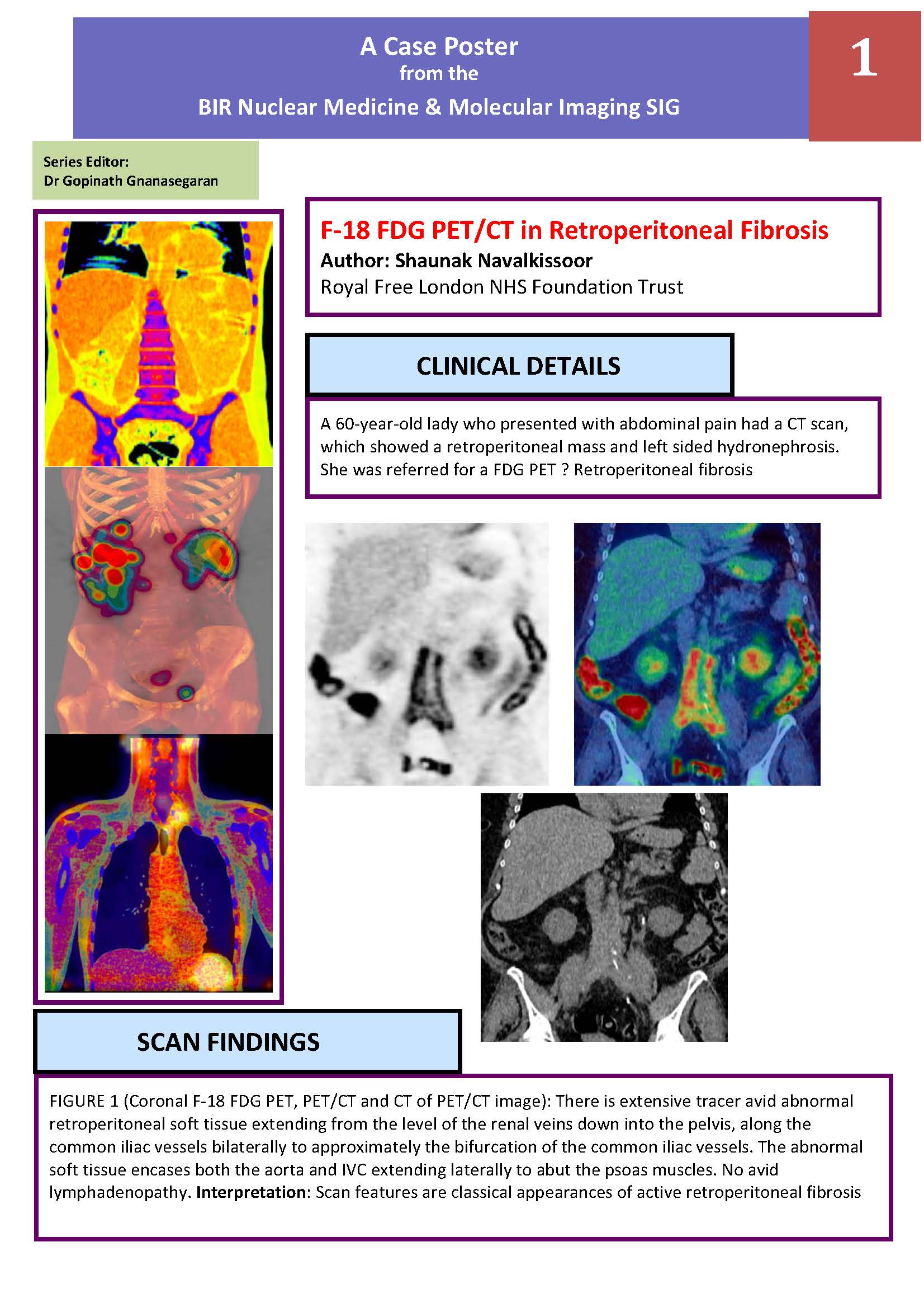 nuclear medicine case study presentation