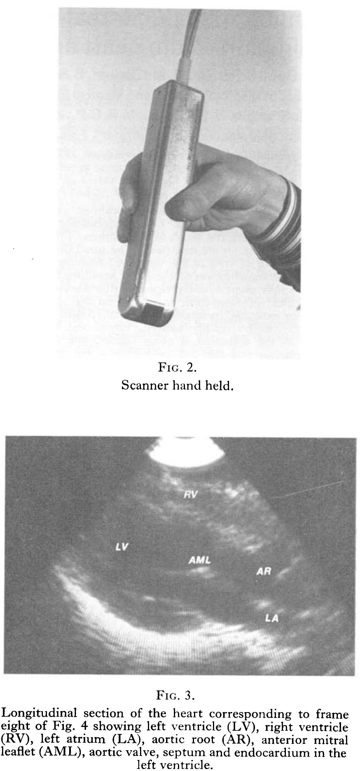 Rotating transducer and scan of heart Rotating transducer and scan of heart