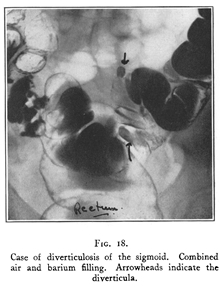 Diagnostic imaging