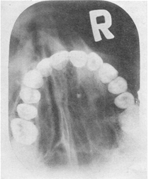 Radiography