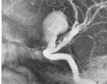 Diagnostic imaging