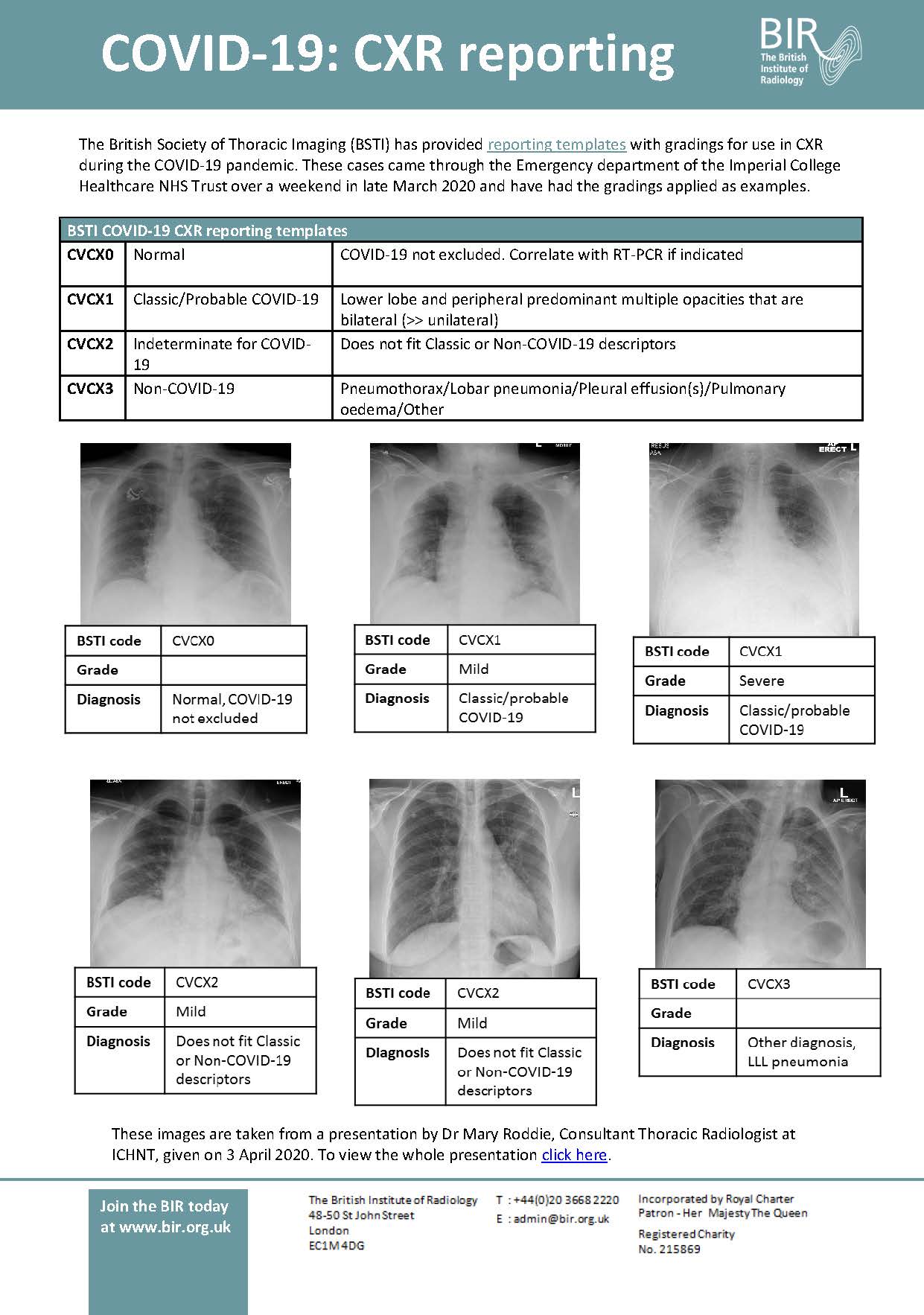 COVID19 CXR Advice Sheets British Institute of Radiology