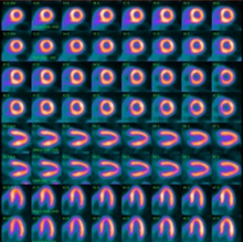 Rubidium-82 PET Imaging Science and practice