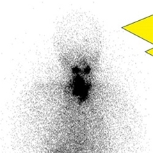 Overview of Theranostics